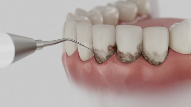 Reliable Emergency Dentist contractor in Dormont, PA by Smile Center Dentistry